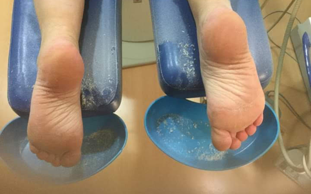 Imagen Pies para el Apartado del Blog Clinica del Pie Eduardo Alvarez Tarifa en Motril