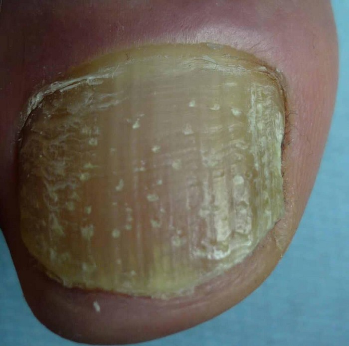 Imagenes para Galeria de Fotos Clinica del Pie Eduardo Alvarez Tarifa en Motril